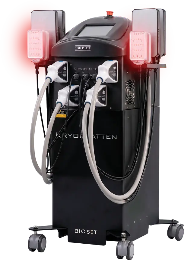 KRYOPLATTEN